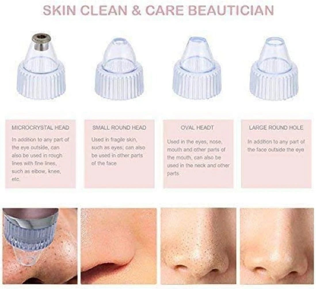 π§Ό Deep Clean Pore Vacuum β¨ USB Rechargeable | Blackhead Remover Tool πββ